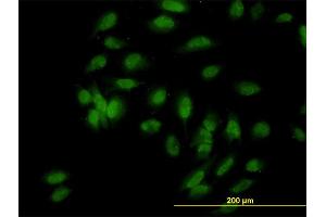 Immunofluorescence of monoclonal antibody to UBE3A on HeLa cell. (ube3a antibody  (AA 51-150))