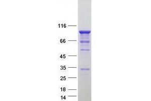 UBTF Protein (Transcript Variant 2) (Myc-DYKDDDDK Tag)