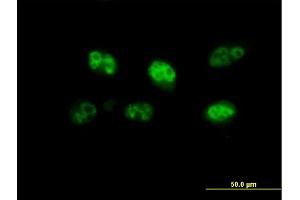 Immunofluorescence of purified MaxPab antibody to FBXO7 on HeLa cell. (FBXO7 antibody  (AA 1-522))