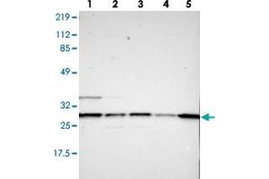 Western blot analysis of lane 1: RT-4, lane 2: U-251 MG, lane 3: A-431, lane 4: Liver and lane 5: Tonsil using RAB27A polyclonal antibody . (RAB27A antibody)