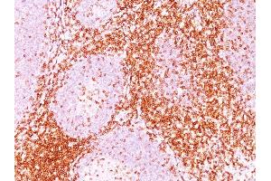 Immunohistochemistry (IHC) image for anti-CD6 (CD6) antibody (ABIN6941059)