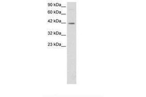 Image no. 3 for anti-FOS-Like Antigen 2 (FOSL2) (AA 208-256) antibody (ABIN6735784) (FOSL2 antibody  (AA 208-256))