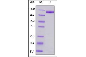 Mouse SIRP alpha, Fc Tag on  under reducing (R) condition. (SIRPA Protein (AA 32-373) (Fc Tag))
