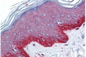 Human Skin: Formalin-Fixed, Paraffin-Embedded (FFPE) (FZD4 antibody  (C-Term))