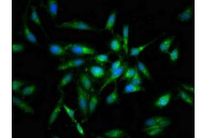 Immunofluorescent analysis of Hela cells using ABIN7165698 at dilution of 1:100 and Alexa Fluor 488-congugated AffiniPure Goat Anti-Rabbit IgG(H+L) (PKC beta antibody  (AA 517-643))