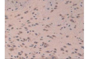 Detection of EIF3A in Mouse Brain Tissue using Polyclonal Antibody to Eukaryotic Translation Initiation Factor 3A (EIF3A) (EIF6 antibody  (AA 622-848))