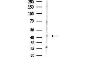anti-Solute Carrier Family 22 Member 18 (SLC22A18) (C-Term) antibody