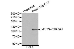 Western blot analysis of extracts of various cell lines, using Phospho-FLT3-Y589/591 antibody (ABIN5995603). (FLT3 antibody  (pTyr589, pTyr591))
