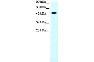 Human Jurkat; WB Suggested Anti-SLC17A2 Antibody Titration: 0.