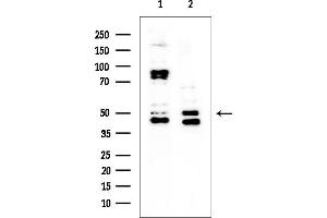 Western blot analysis of lysates from various samples, using Parkin Mouse Monoclonal Antibody at 1/1000 dilution.
