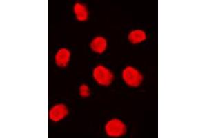 Immunofluorescent analysis of MEKK3 staining in Raji cells. (MAP3K3 antibody  (Center))