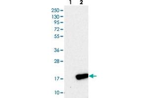 Western blot analysis of Lane 1: Negative control (vector only transfected HEK293T lysate), Lane 2: Over-expression Lysate (Co-expressed with a C-terminal myc-DDK tag (~3. (PLGRKT antibody)
