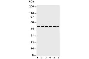 Western Blotting (WB) image for anti-SMAD, Mothers Against DPP Homolog 2 (SMAD2) (N-Term) antibody (ABIN3032617)