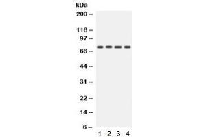 Western blot testing of human 1) A431, 2) A549, 3) HeLa and 4) SKOV lysate with PKC eta antibody.