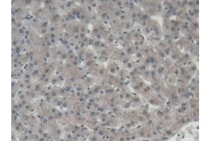 DAB staining on IHC-P; Samples: Porcine Liver Tissue (ORM1 antibody  (AA 2-171))