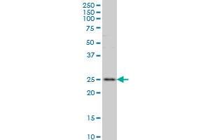 RAB7L1 antibody  (AA 1-203)