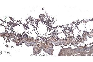 (ABIN185099) (6 μg/mL) staining of paraffin embedded Human Lung. (ARAP1 antibody  (C-Term))