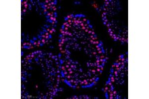 Immunofluorescence of paraffin embedded mouse testis using SNRNP200 (ABIN7075632) at dilution of 1: 650 (250x lens) (SNRNP200 antibody)