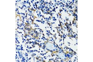 Immunohistochemistry of paraffin-embedded human tonsil using HD antibody (ABIN6133742, ABIN6141675, ABIN6141678 and ABIN6213911) at dilution of 1:100 (40x lens). (HDAC5 antibody  (AA 550-650))
