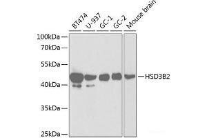 Western blot analysis of extracts of various cell lines using HSD3B2 Polyclonal Antibody at dilution of 1:1000. (HSD3B2 antibody)