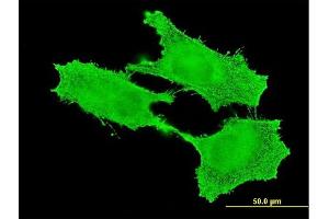 Immunofluorescence of monoclonal antibody to SMC1B on HeLa cell. (SMC1B antibody  (AA 551-660))