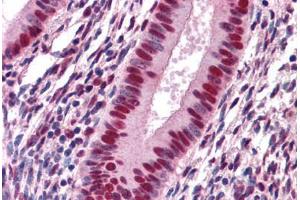 Human Uterus: Formalin-Fixed, Paraffin-Embedded (FFPE) (SAFB antibody  (AA 111-201))