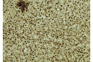 ABIN6273062 at 1/100 staining Mouse liver tissue by IHC-P. (OTUD7B antibody  (C-Term))
