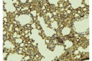 ABIN6277396 at 1/100 staining Mouse lung tissue by IHC-P. (Leptin Receptor antibody  (C-Term))