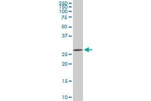 CDK4 monoclonal antibody (M06), clone 6D7. (CDK4 antibody  (AA 211-303))