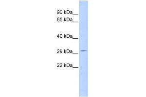SCOTIN antibody used at 1 ug/ml to detect target protein.