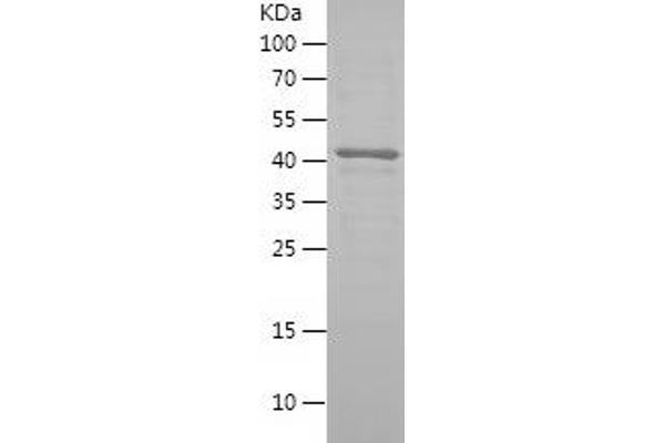 TXNIP Protein (AA 22-382) (His-IF2DI Tag)