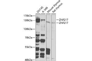 ZNF217 Antikörper  (AA 1-190)