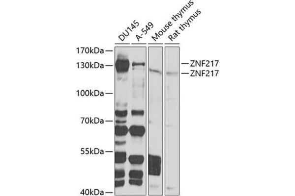 ZNF217 Antikörper  (AA 1-190)