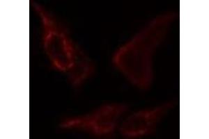 ABIN6276392 staining  COLO205 cells by IF/ICC. (STEAP3 antibody  (N-Term))