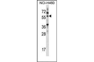Western blot analysis of MINPP1 Antibody (C-term) in NCI-H460 cell line lysates (35ug/lane). (MINPP1 antibody  (C-Term))