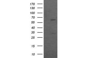 Image no. 2 for anti-Chaperonin Containing TCP1, Subunit 8 (Theta)-Like 2 (CCT8L2) antibody (ABIN1497482) (CCT8L2 antibody)