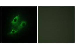 Immunofluorescence analysis of NIH-3T3 cells, using SERC2 Antibody.
