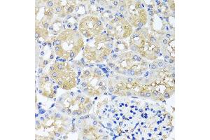 Immunohistochemistry of paraffin-embedded mouse kidney using HARS2 antibody at dilution of 1:100 (x40 lens). (HARS2 antibody)