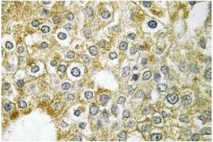 Image no. 2 for anti-Activin A Receptor Type II-Like 1 (ACVRL1) antibody (ABIN317607)