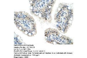 Rabbit Anti-NOL6 Antibody  Paraffin Embedded Tissue: Human Intestine Cellular Data: Epithelial cells of intestinal villas Antibody Concentration: 4. (Nucleolar Protein 6 antibody  (C-Term))