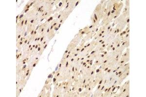 Immunohistochemistry of paraffin-embedded Human colon using SUPT20H Polyclonal Antibody at dilution of 1:100 (40x lens). (FAM48A/P38IP antibody)