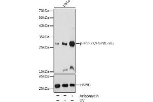 Western blot analysis of extracts of HeLa cells, using Phospho-HSP27/HSPB1-S82 pAb (ABIN3023549, ABIN3023550, ABIN3023551 and ABIN6225403) at 1:1000 dilution or HSP27/HSPB1 antibody (ABIN7267568). (HSP27 antibody  (pSer82))