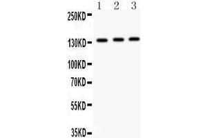 Western Blotting (WB) image for anti-Insulin Receptor Substrate 1 (IRS1) (AA 1041-1242) antibody (ABIN3043251)
