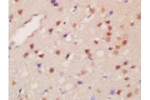 Formalin-fixed and paraffin embedded rat brain labeled with Rabbit Anti-JMJD2B(Thr305) Polyclonal Antibody, Unconjugated  at 1:200 followed by conjugation to the secondary antibody and DAB staining (KDM4B antibody  (pThr305))