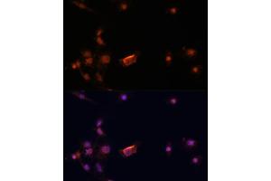 Immunofluorescence analysis of C6 cells using BRC antibody (435) at dilution of 1:100. (BRCA2 antibody  (AA 1-300))