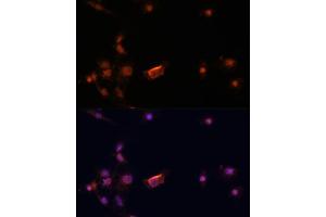 Immunofluorescence analysis of C6 cells using BRC antibody (435) at dilution of 1:100. (BRCA2 antibody  (AA 1-300))