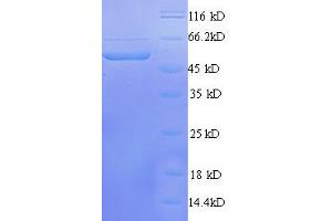 SDS-PAGE (SDS) image for Transcriptional Adaptor 3 (TADA3) (AA 1-238), (partial) protein (GST tag) (ABIN7479322)
