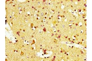 Immunohistochemistry (IHC) image for anti-Melanocortin 1 Receptor (MC1R) (AA 1-37) antibody (ABIN7159233)