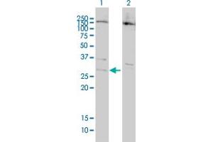 Western Blot analysis of BCL7B expression in transfected 293T cell line by BCL7B monoclonal antibody (M01), clone 6D2. (BCL7B antibody  (AA 124-202))