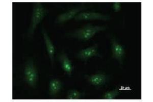 Immunostaining analysis in HeLa cells. (DDX27 antibody)